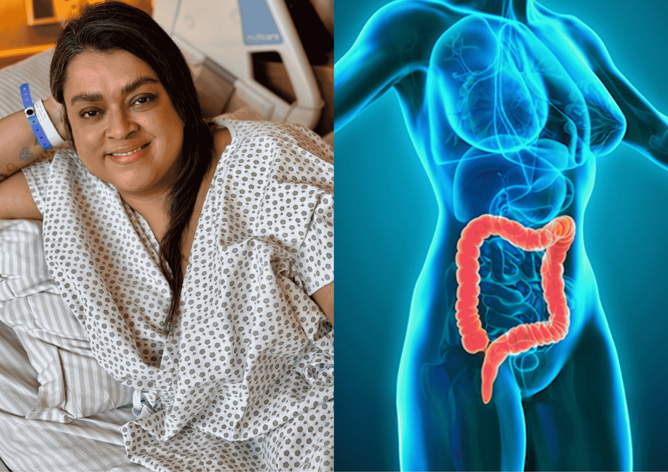 Você saberia reconhecer os sinais do câncer que levou Preta Gil?