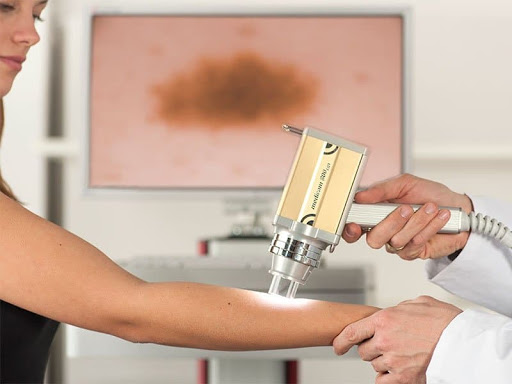 Hospital Moinhos de Vento inaugura centro avançado para rastreamento digital de lesões de pele