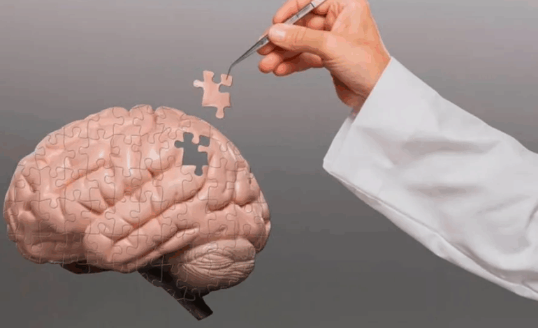 8 alimentos que ajudam a fortalecer a memória após os 60 anos