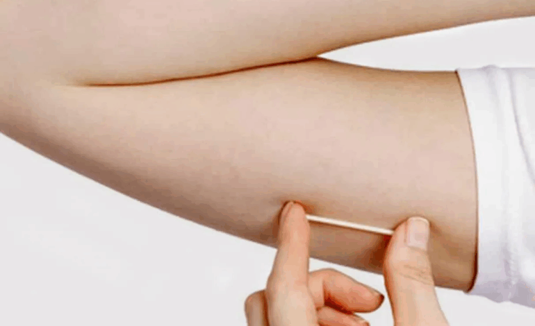 Planos de saúde passam a incluir implante contraceptivo hormonal na cobertura obrigatória