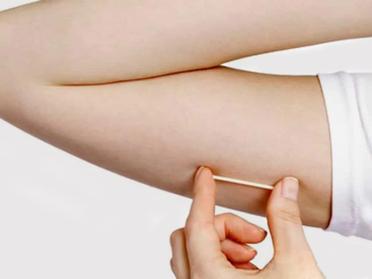 Planos de saúde passam a incluir implante contraceptivo hormonal na cobertura obrigatória
