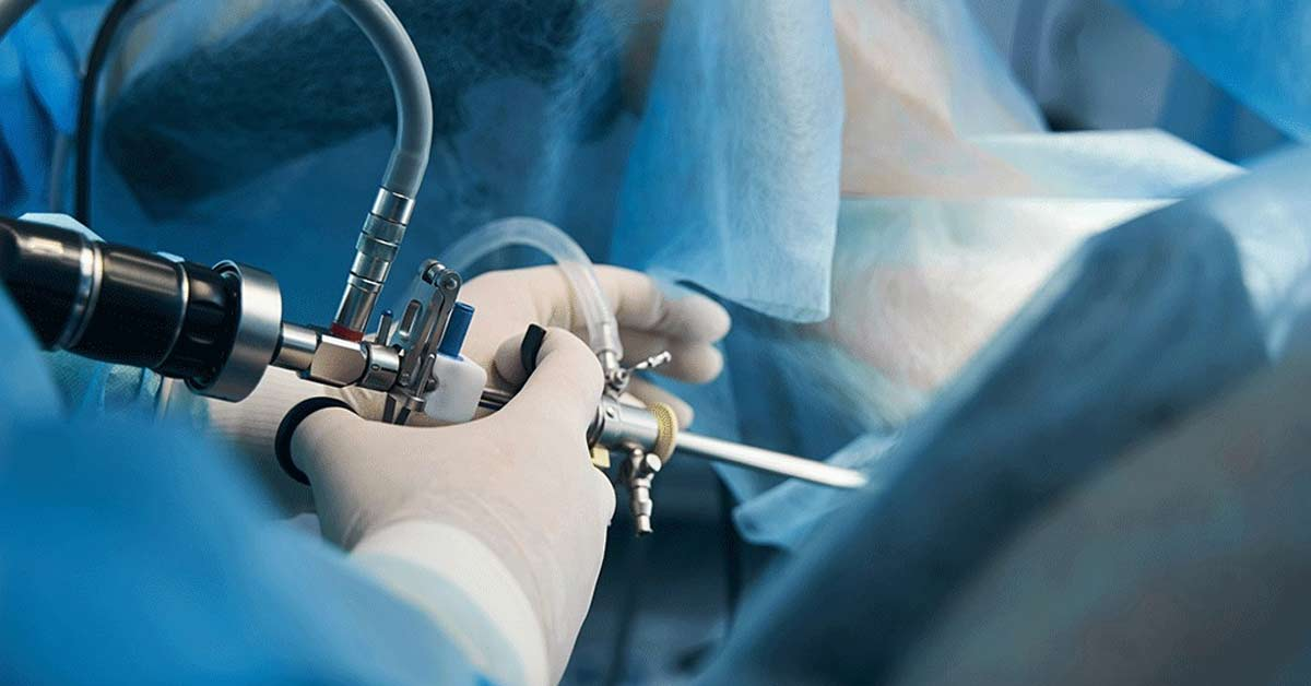 Histeroscopia: técnica padrão ouro fortalece o cuidado ginecológico na Hapvida 